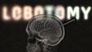 Lobotomy